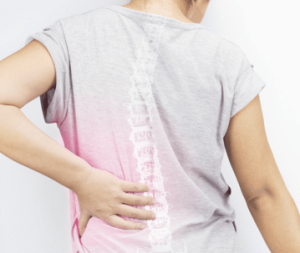 Woman with back pain.