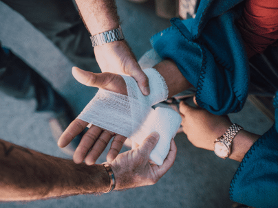 Injured hand from an accident.